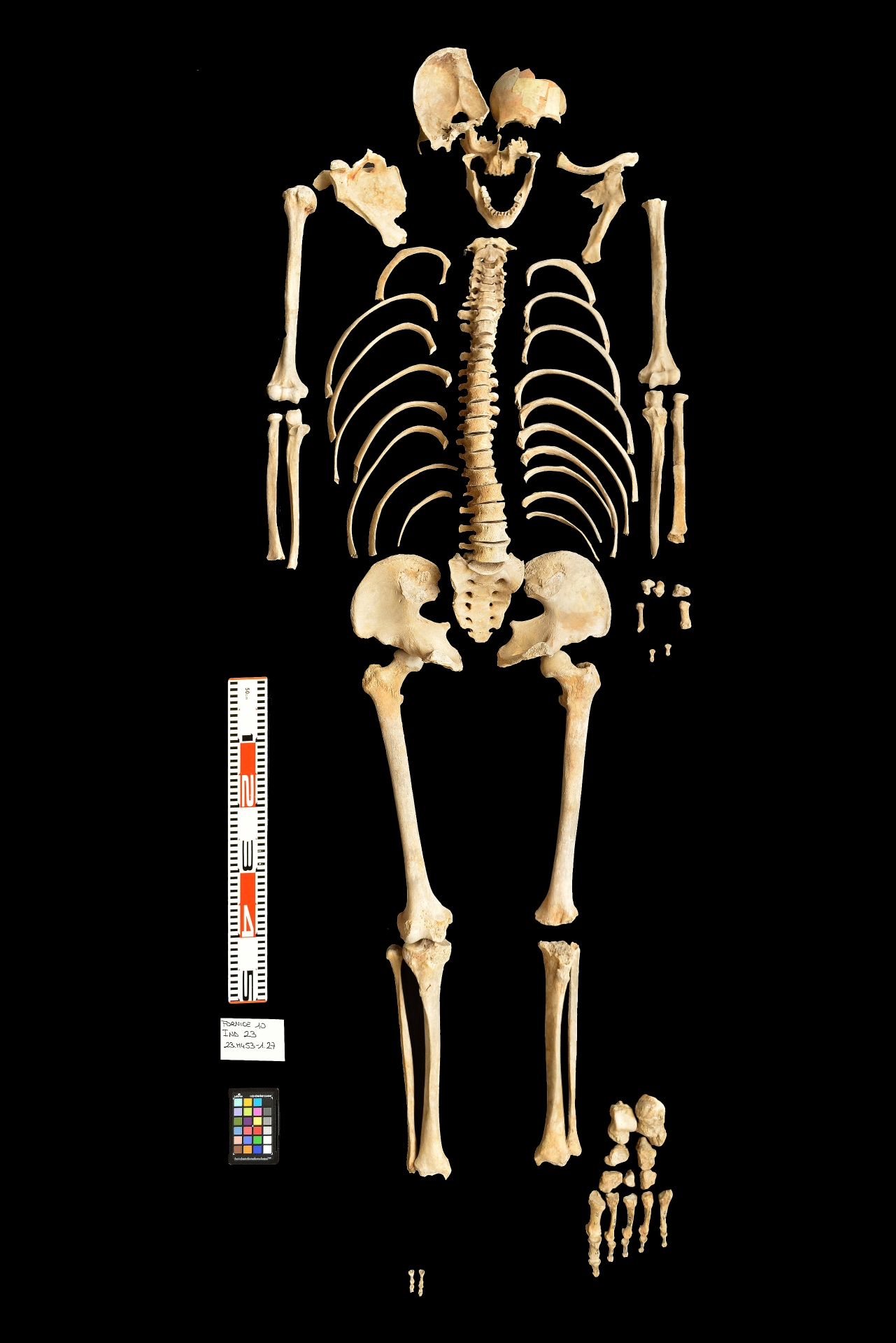 reperti antropologici pertinenti a un unico individuo, reperto osteo dentario (sec. I d.C)