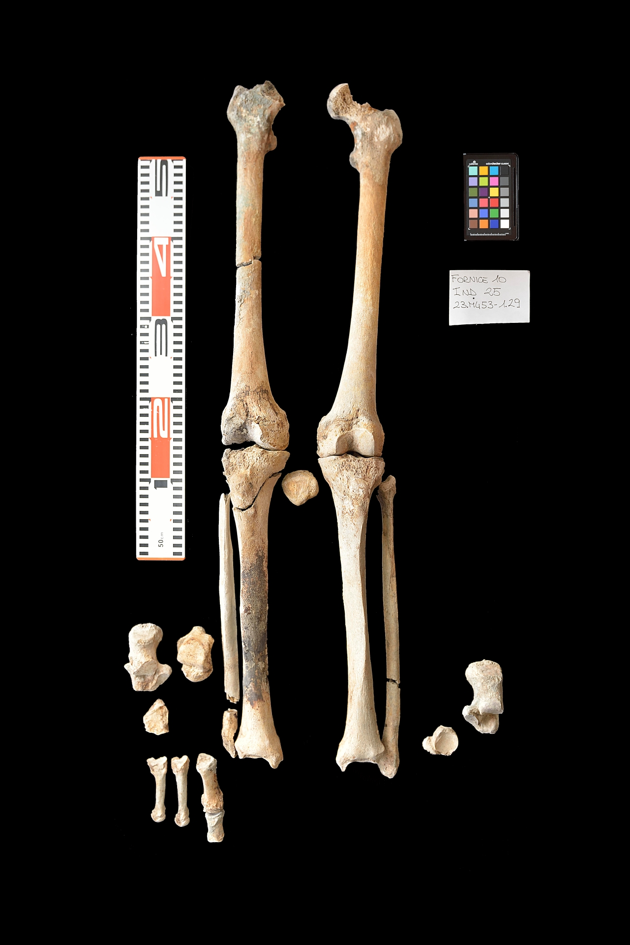 reperti antropologici pertinenti a un unico individuo, reperto osteo dentario (sec. I d.C)