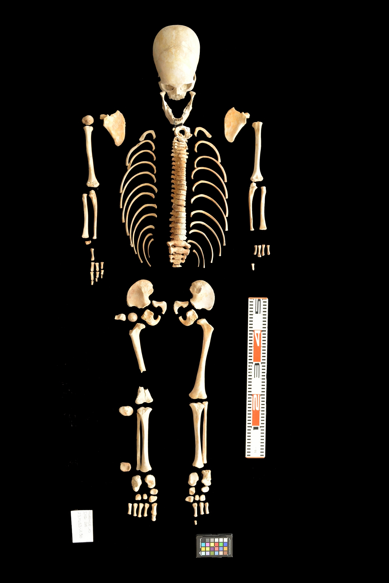 reperti antropologici pertinenti a un unico individuo, reperto osteo dentario (sec. I d.C)