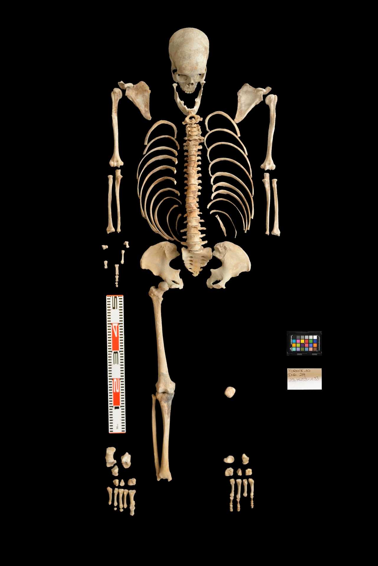 reperti antropologici pertinenti a un unico individuo, reperto osteo dentario (sec. I d.C)