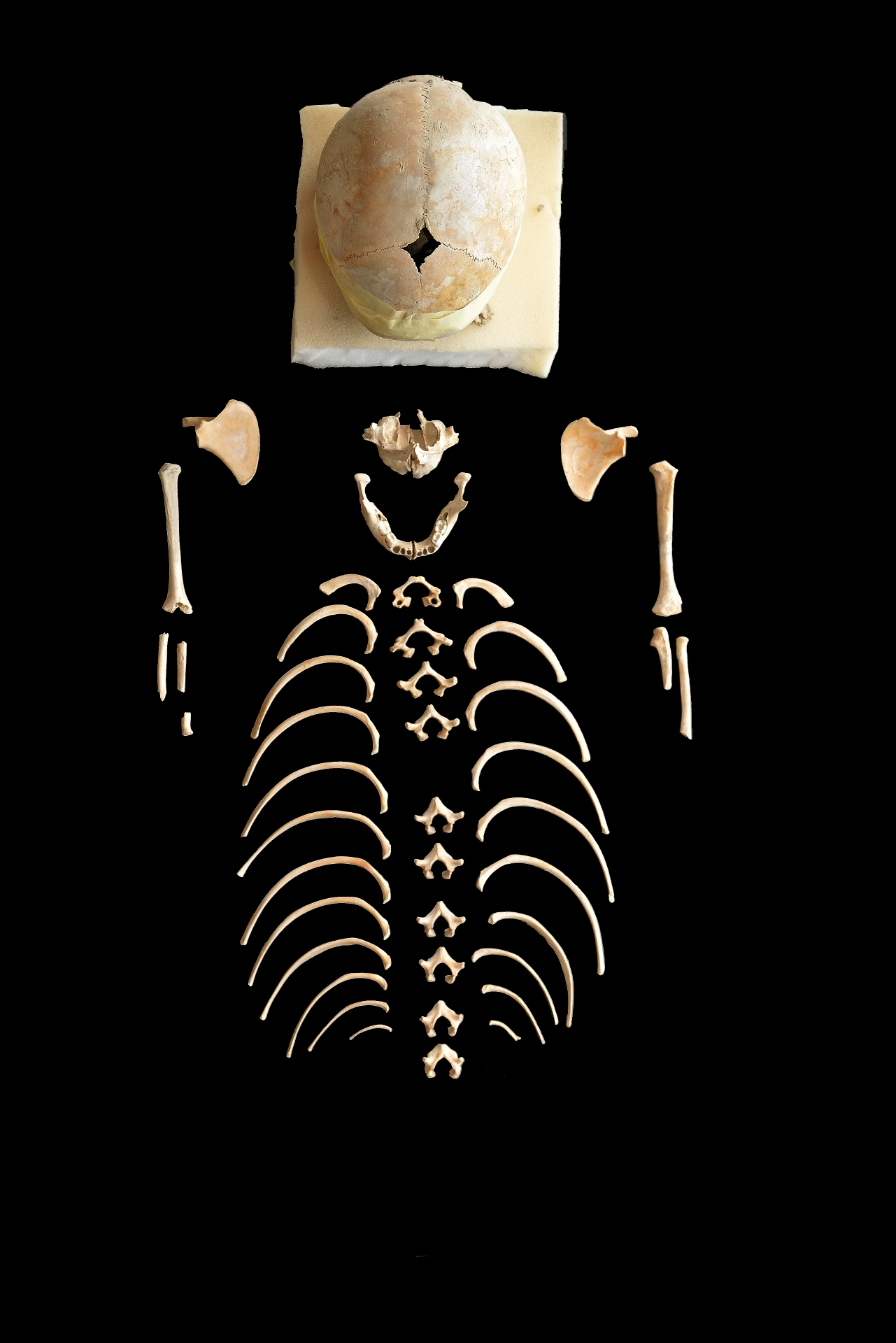 reperti antropologici pertinenti a un unico individuo, reperto osteo dentario (sec. I d.C)