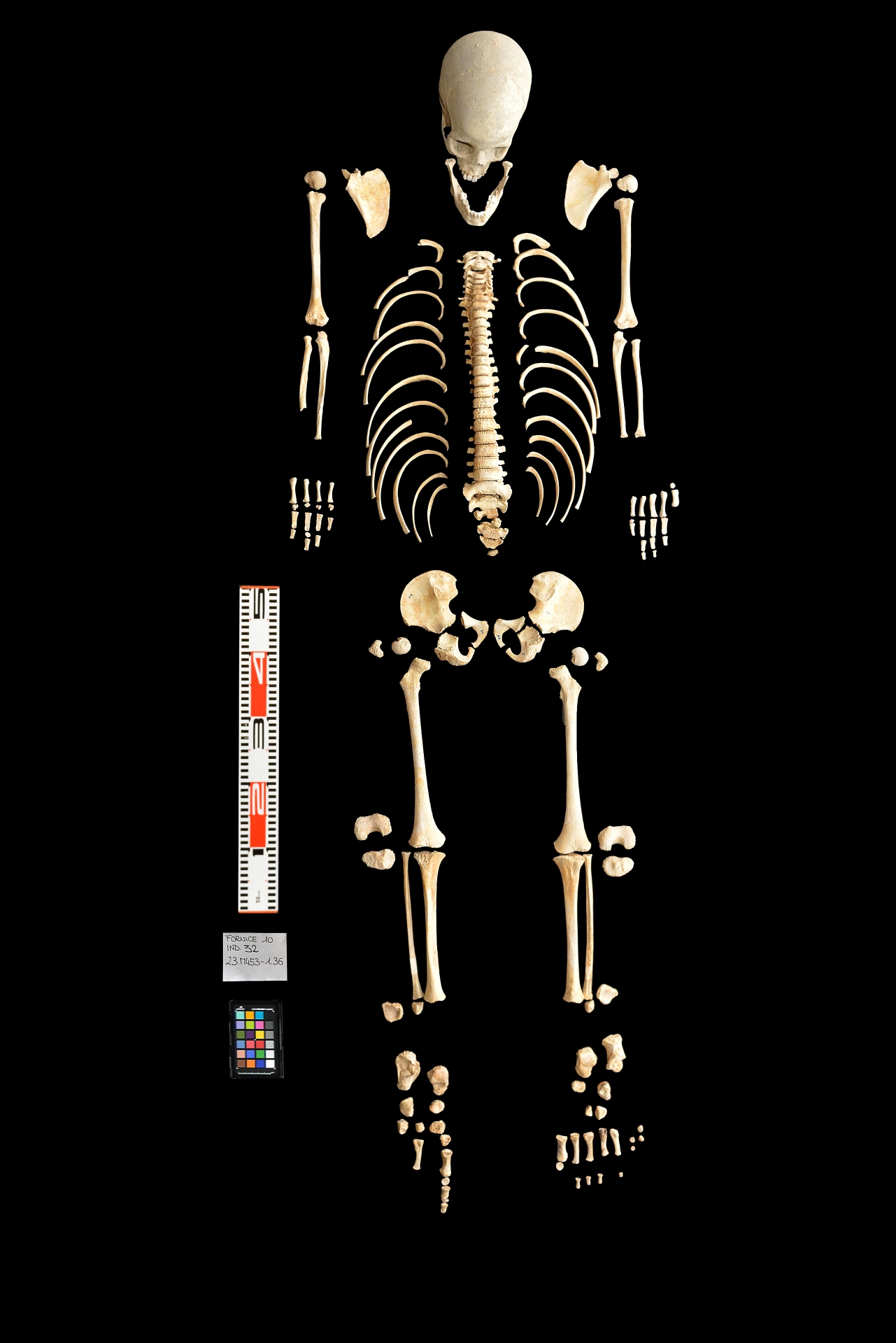 reperti antropologici pertinenti a un unico individuo, reperto osteo dentario (sec. I d.C)