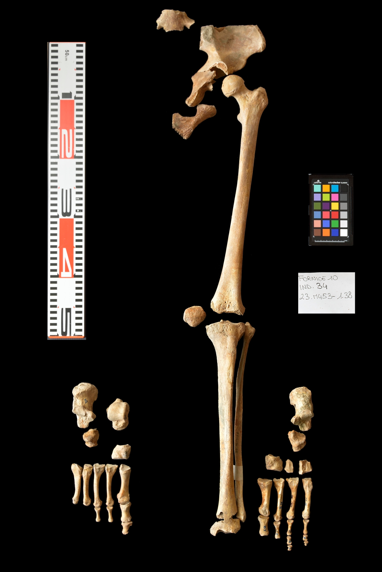 reperti antropologici pertinenti a un unico individuo, reperto osteo dentario (sec. I d.C)