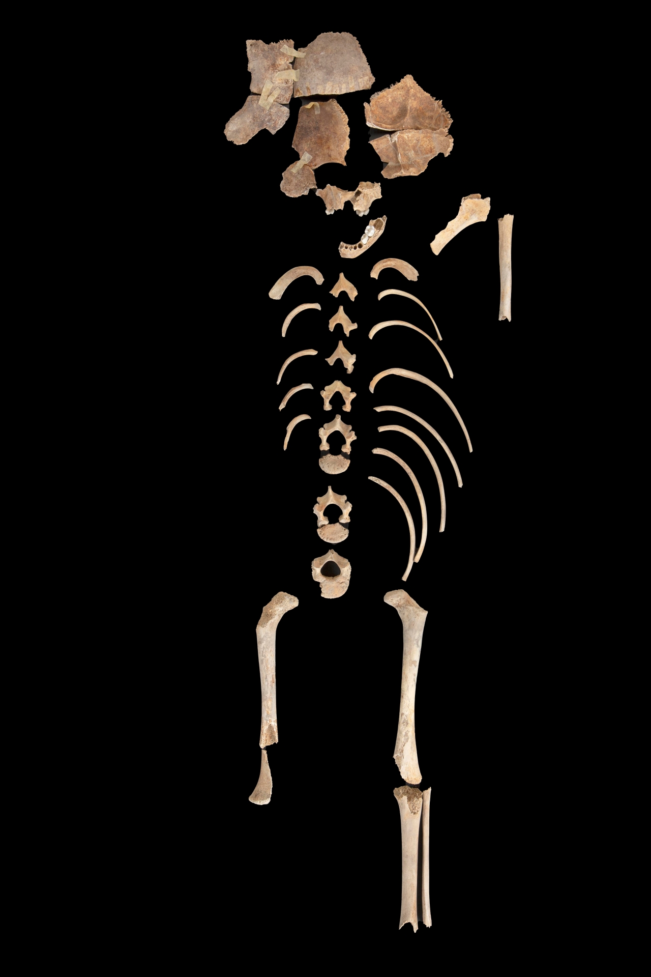 reperti antropologici pertinenti a un unico individuo, reperto osteo dentario (sec. I d.C)