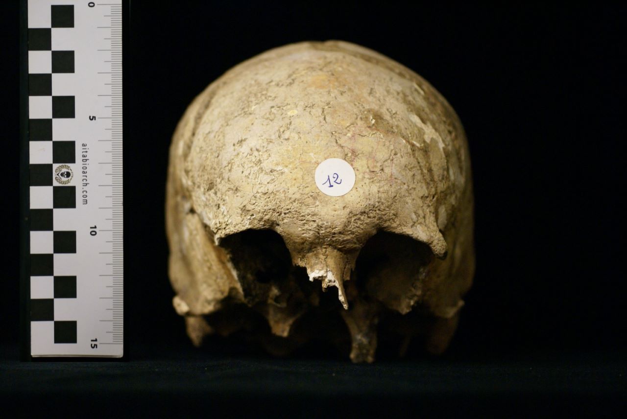 SINGOLO OGGETTO/ reperto osseo, SECOLI/ ARCHI DI SECOLI/ VI-VII