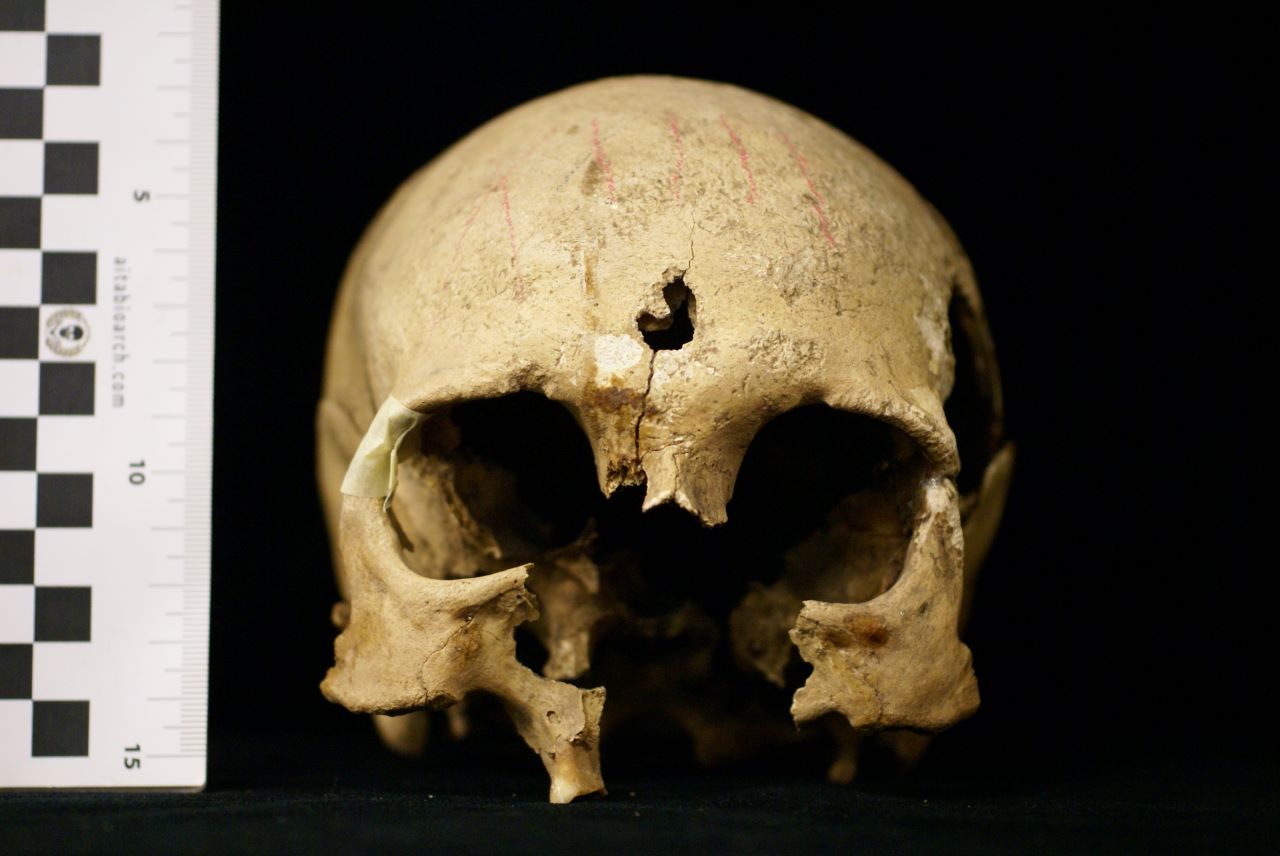 SINGOLO OGGETTO/ reperto osseo, SECOLI/ ARCHI DI SECOLI/ VI-VII