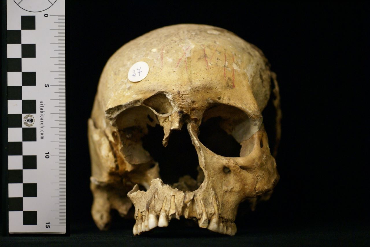 SINGOLO OGGETTO/ reperto osseo, SECOLI/ ARCHI DI SECOLI/ VI-VII